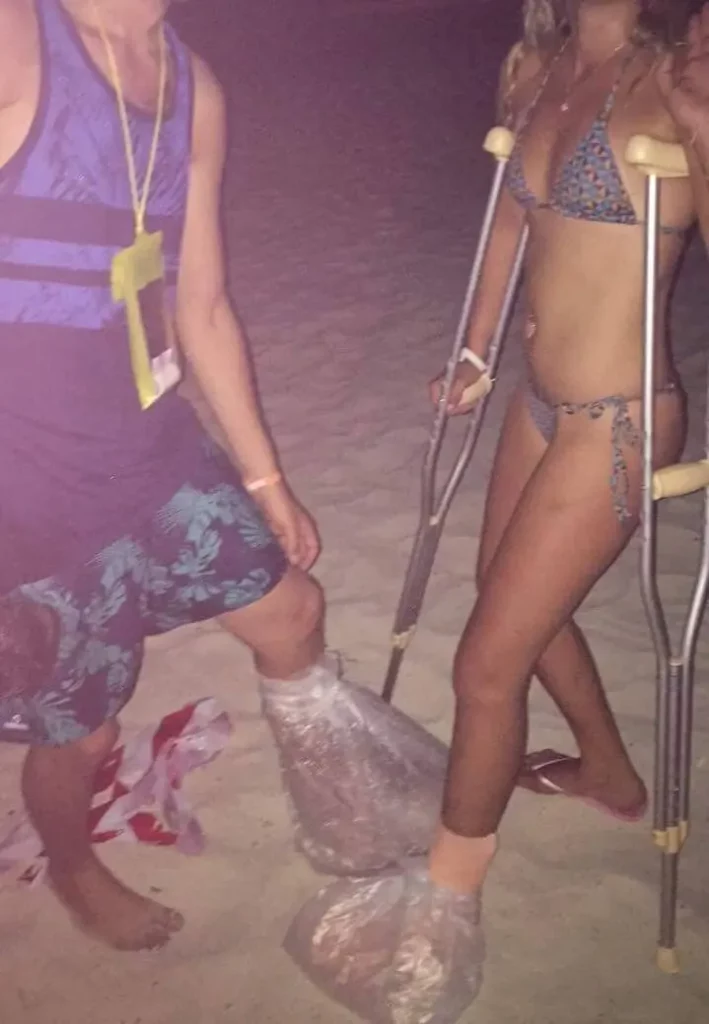 Author with a medicated foot meeting a girl with the same injury, highlighting shared experiences during travel.